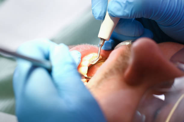 Best Broken Tooth Emergency  in Highland Heights, OH