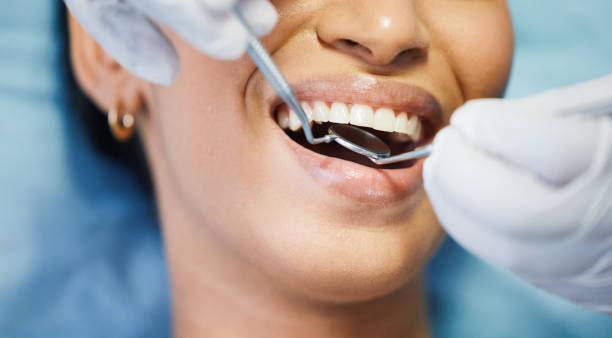 Best Knocked-Out Tooth Emergency  in Highland Heights, OH
