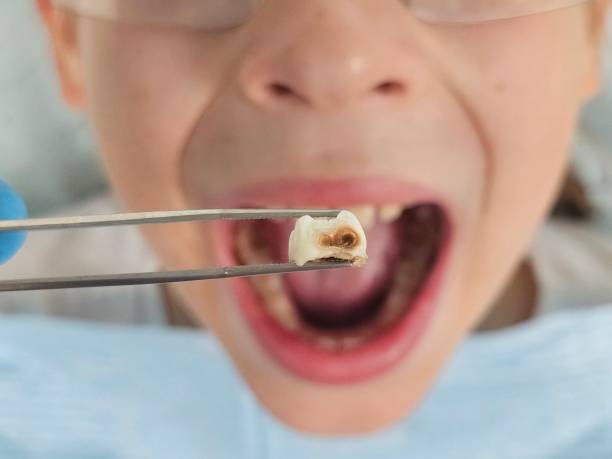 Best Chipped Tooth Repair Near Me  in Highland Heights, OH